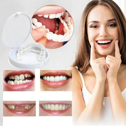 Snap on Smile Veneers - Directe Smaakvolle Glimlach Transformatie